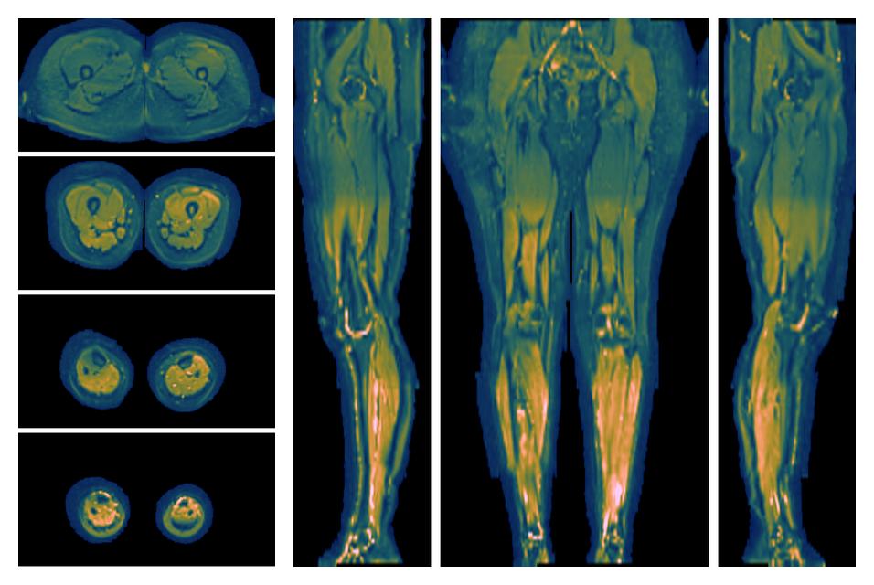 SNR distribution of the unweighted diffusion data.