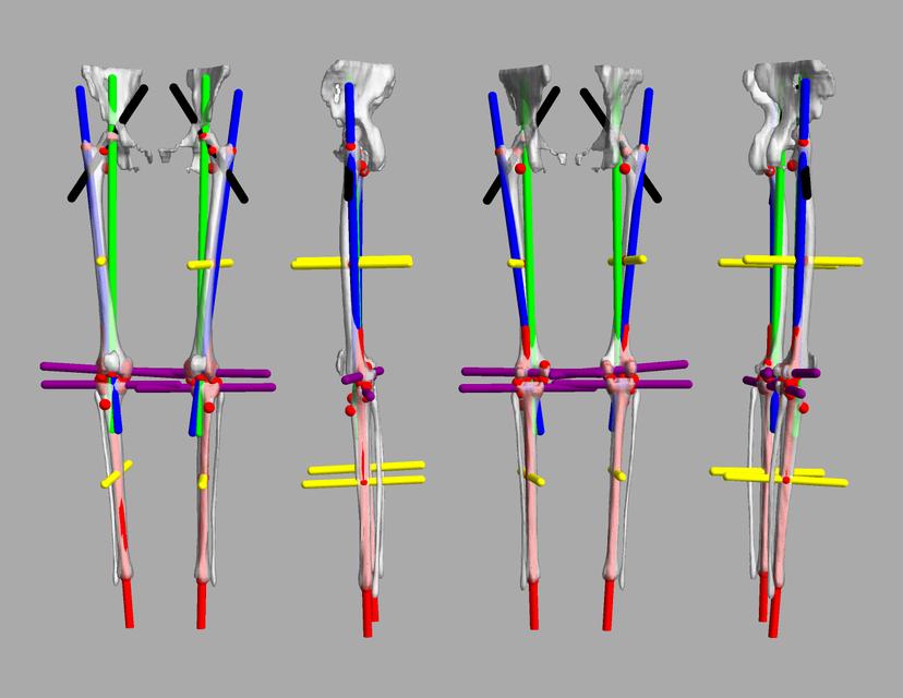 3D render of automated bone segmentation and force lines.