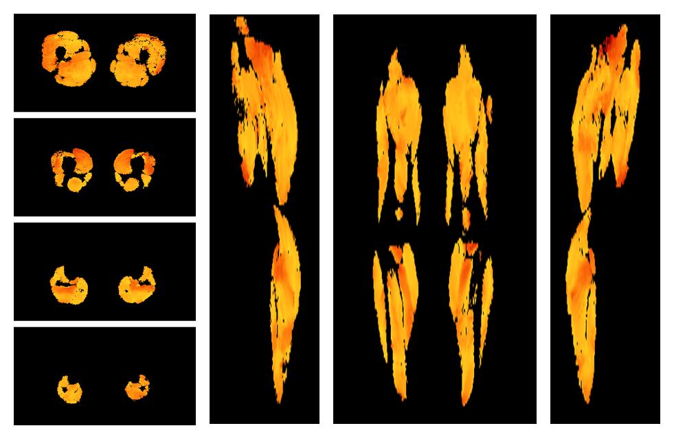 Muscle fiber tract angle map based on whole leg DTI based fiber tractography.