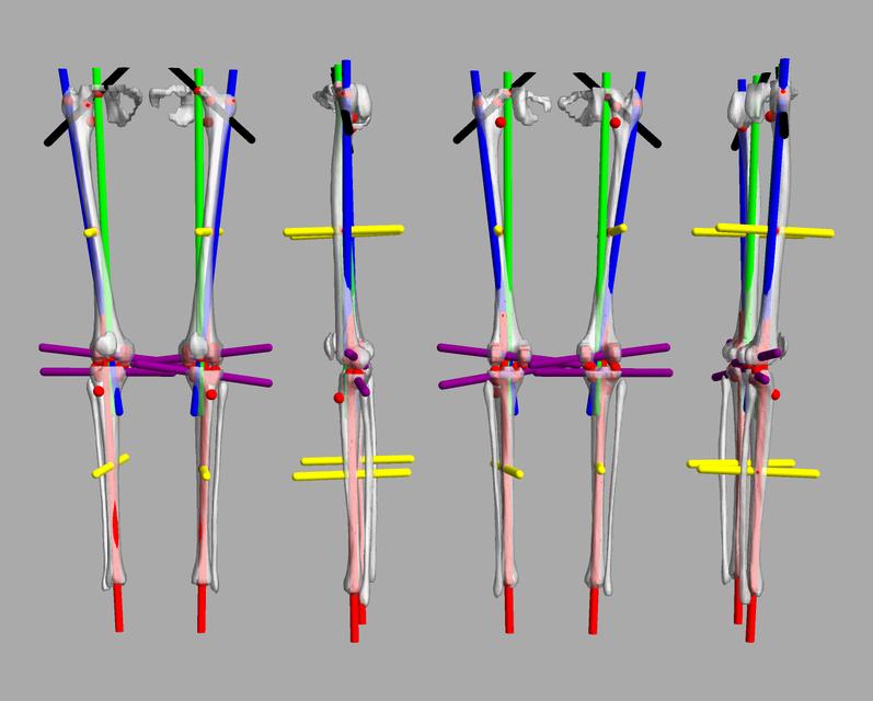 3D render of automated bone segmentation and force lines.