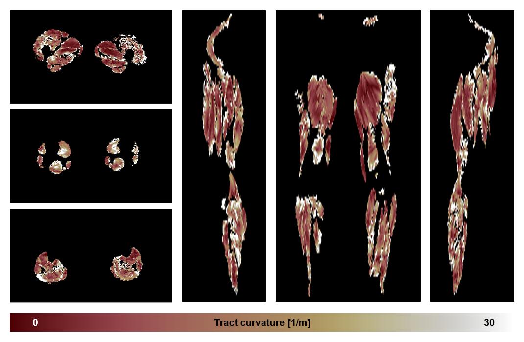 Muscle fiber tract curvature map based on whole leg DTI based fiber tractography.