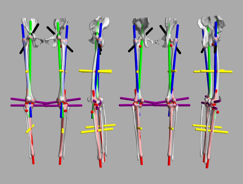 3D render of automated bone segmentation and force lines.