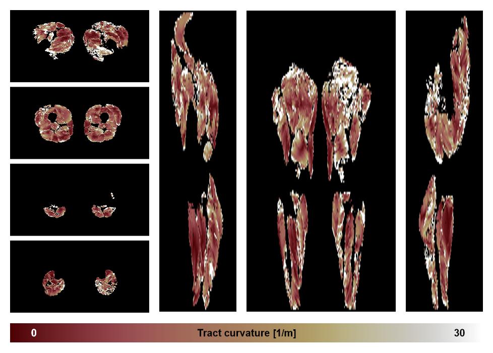 Muscle fiber tract curvature map based on whole leg DTI based fiber tractography.