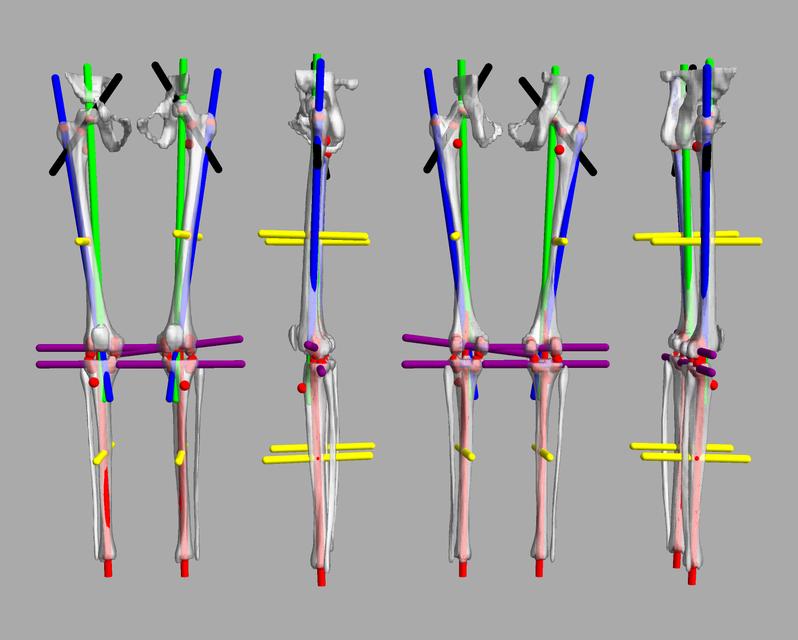 3D render of automated bone segmentation and force lines.