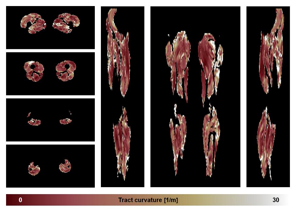 Muscle fiber tract curvature map based on whole leg DTI based fiber tractography.