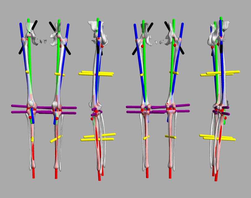 3D render of automated bone segmentation and force lines.