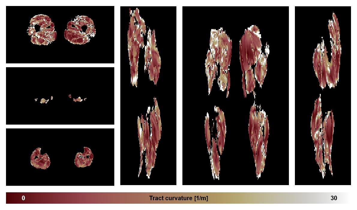 Muscle fiber tract curvature map based on whole leg DTI based fiber tractography.