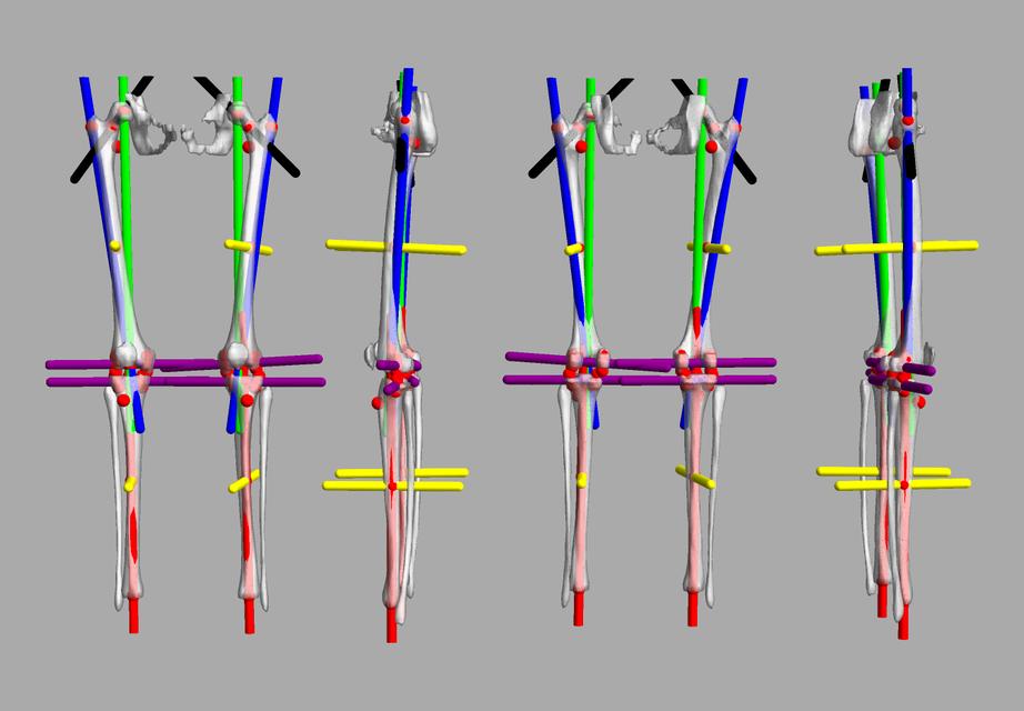 3D render of automated bone segmentation and force lines.