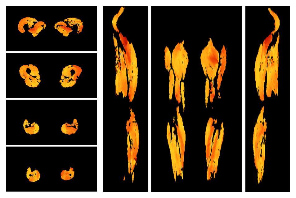 Muscle fiber tract angle map based on whole leg DTI based fiber tractography.