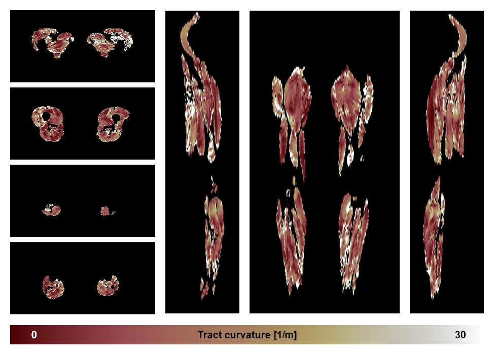 Muscle fiber tract curvature map based on whole leg DTI based fiber tractography.