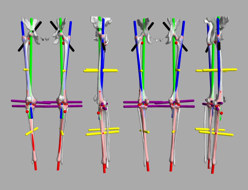 3D render of automated bone segmentation and force lines.