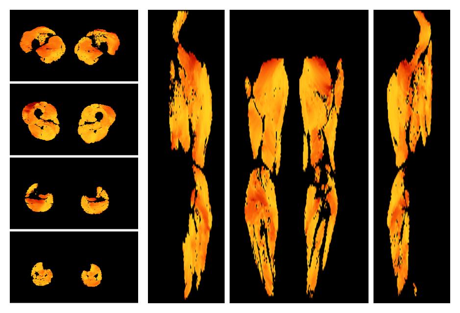 Muscle fiber tract angle map based on whole leg DTI based fiber tractography.