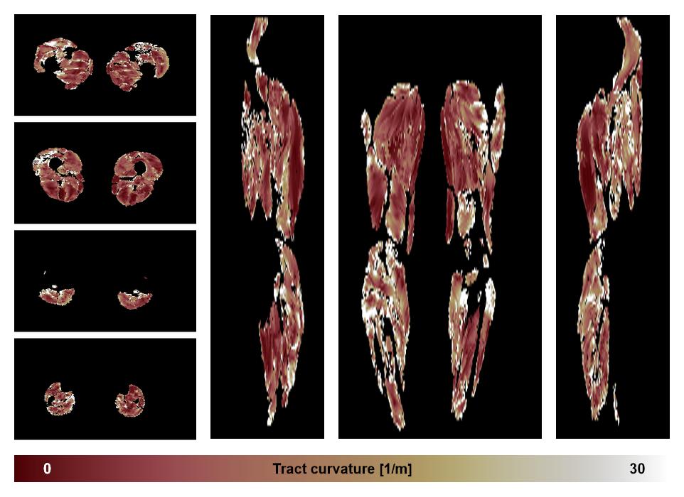 Muscle fiber tract curvature map based on whole leg DTI based fiber tractography.