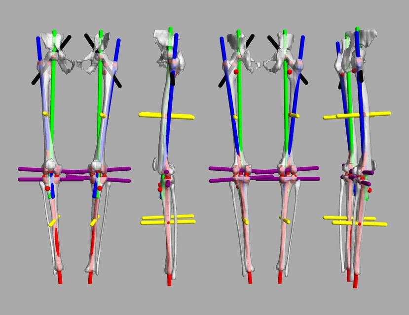 3D render of automated bone segmentation and force lines.