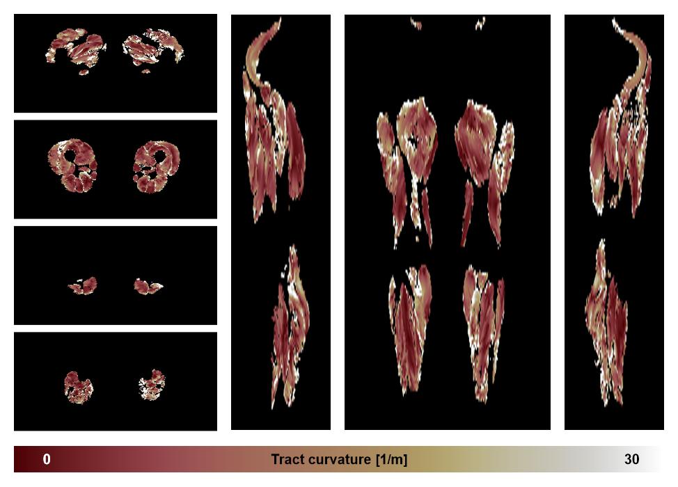 Muscle fiber tract curvature map based on whole leg DTI based fiber tractography.