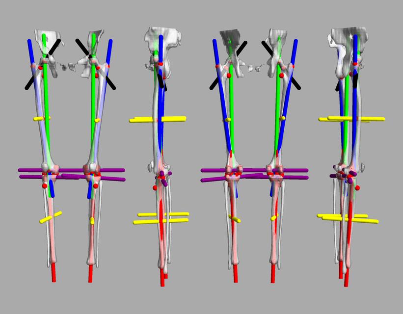 3D render of automated bone segmentation and force lines.