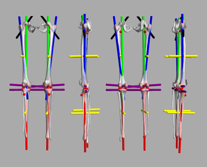 3D render of automated bone segmentation and force lines.