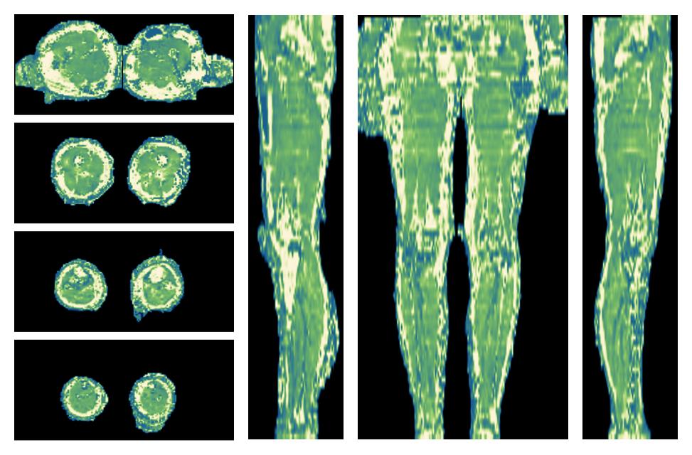 The water only T2 relaxation time of the lower extremity obtained from multi echo spin echo t2 mapping with EPG based reconstruction.