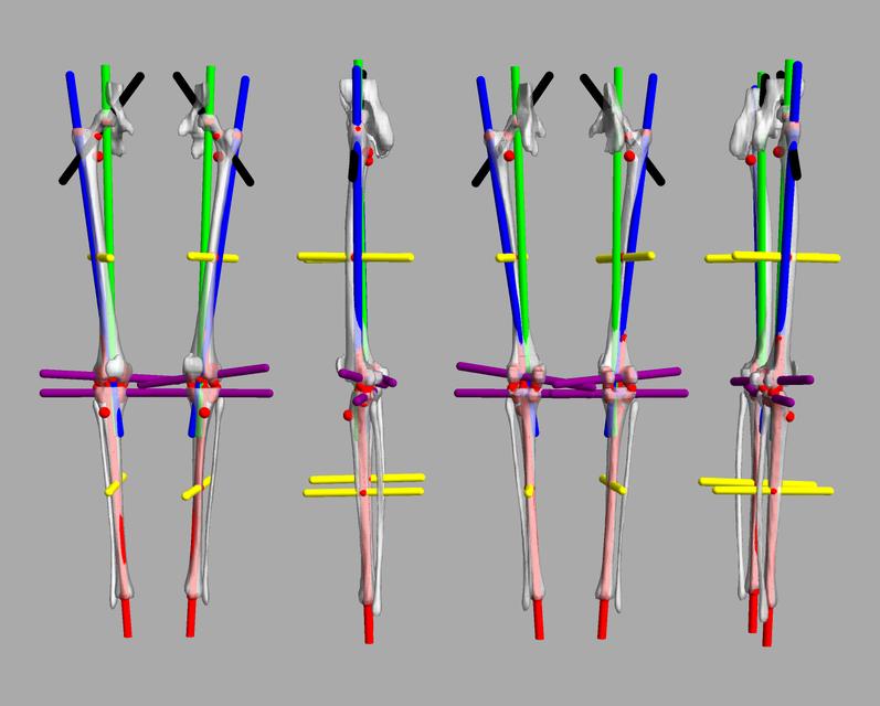 3D render of automated bone segmentation and force lines.