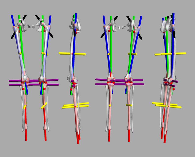 3D render of automated bone segmentation and force lines.