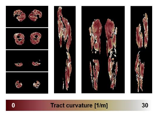 Muscle fiber tract curvature map based on whole leg DTI based fiber tractography.