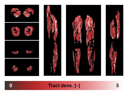 Muscle fiber tract density map based on whole leg DTI based fiber tractography.