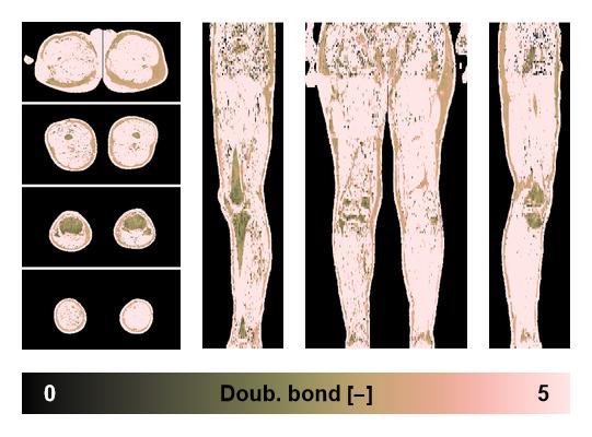 Number of double bonds in subcutanious fat.