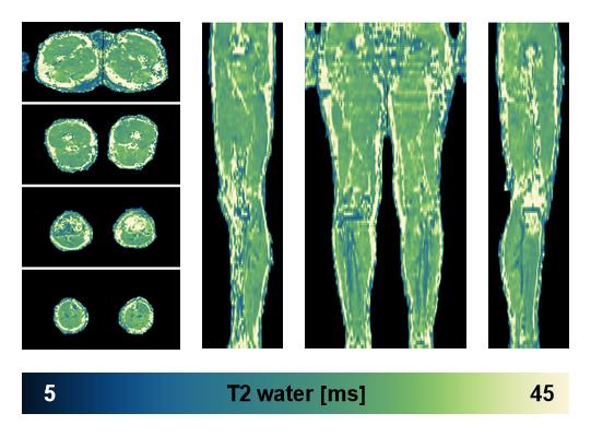 The water only T2 relaxation time of the lower extremity obtained from multi echo spin echo t2 mapping with EPG based reconstruction.