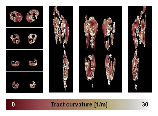 Muscle fiber tract curvature map based on whole leg DTI based fiber tractography.