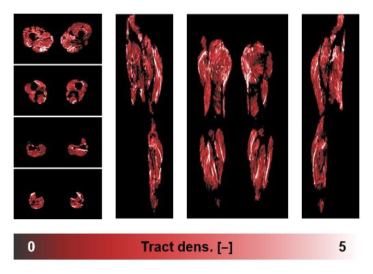 Muscle fiber tract density map based on whole leg DTI based fiber tractography.