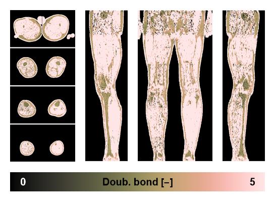 Number of double bonds in subcutanious fat.