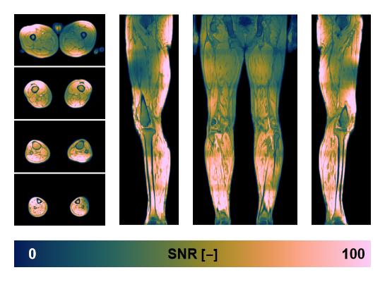 The SNR distribution of the dixon data.