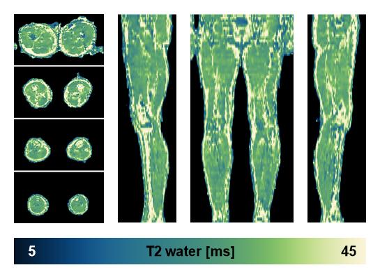 The water only T2 relaxation time of the lower extremity obtained from multi echo spin echo t2 mapping with EPG based reconstruction.