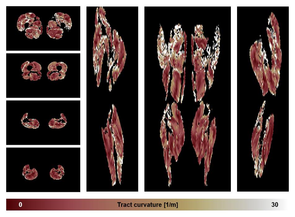 Muscle fiber tract curvature map based on whole leg DTI based fiber tractography.