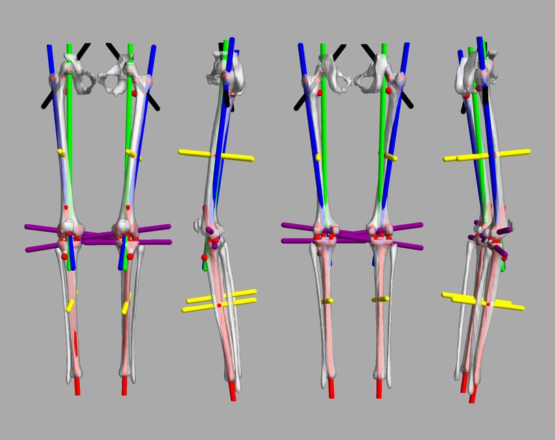 3D render of automated bone segmentation and force lines.