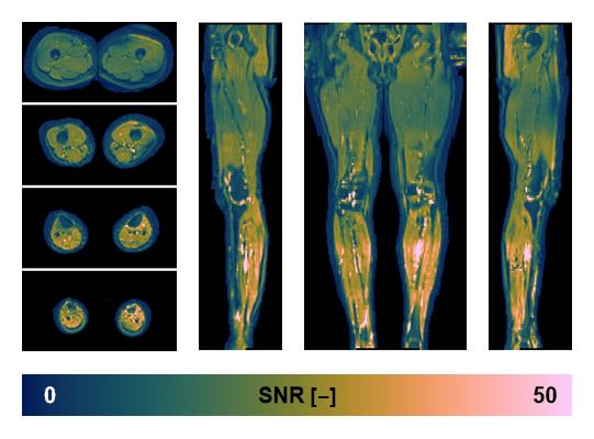 SNR distribution of the unweighted diffusion data.