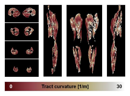 Muscle fiber tract curvature map based on whole leg DTI based fiber tractography.