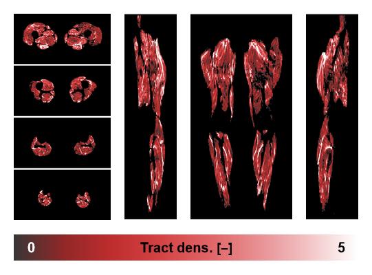 Muscle fiber tract density map based on whole leg DTI based fiber tractography.