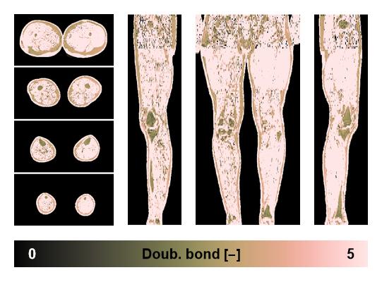 Number of double bonds in subcutanious fat.