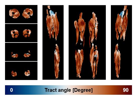 Muscle fiber tract angle map based on whole leg DTI based fiber tractography.