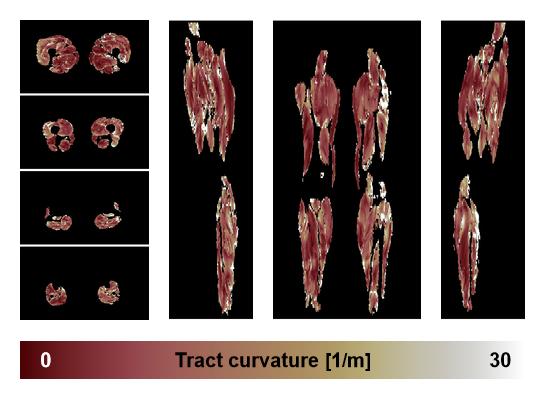 Muscle fiber tract curvature map based on whole leg DTI based fiber tractography.