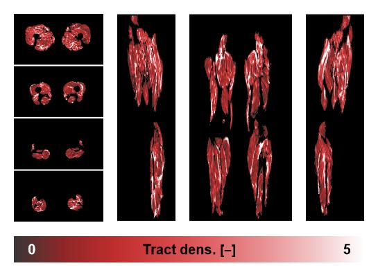 Muscle fiber tract density map based on whole leg DTI based fiber tractography.