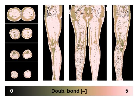 Number of double bonds in subcutanious fat.