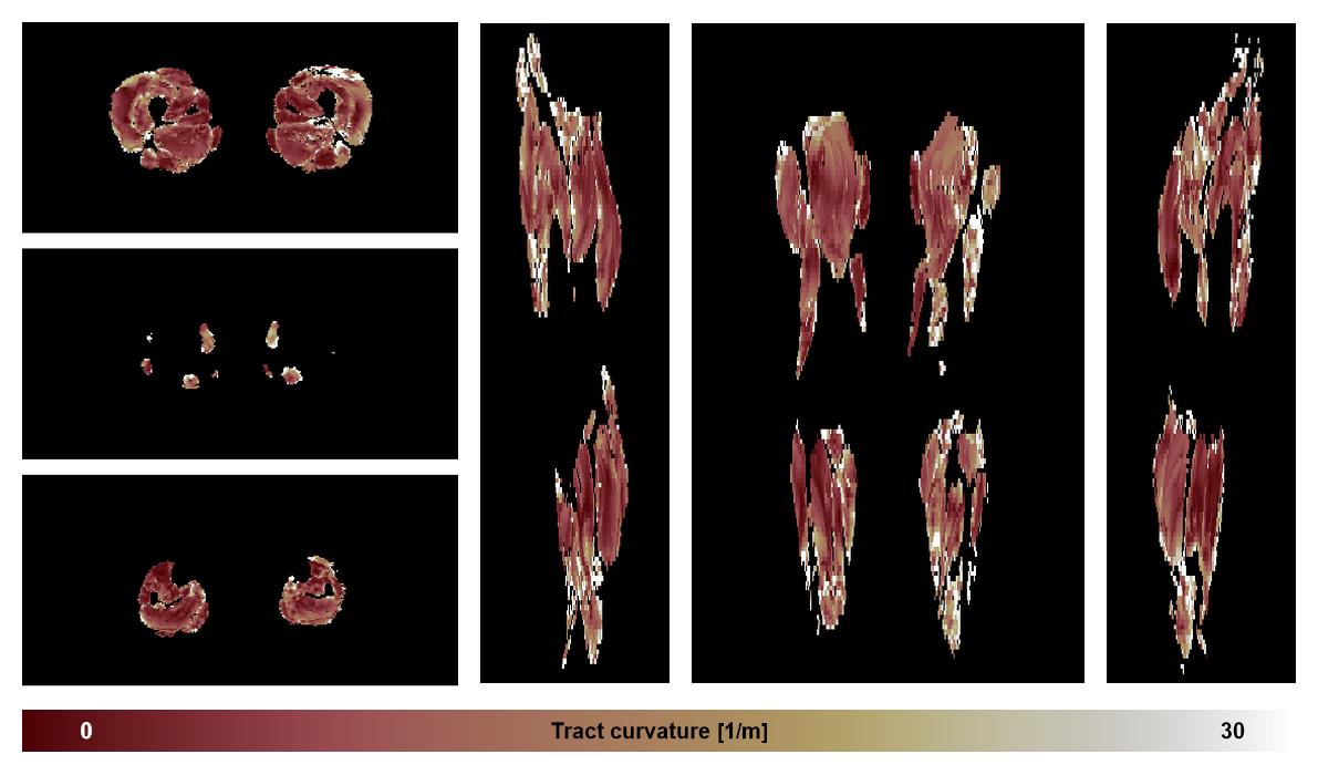 Muscle fiber tract curvature map based on whole leg DTI based fiber tractography.