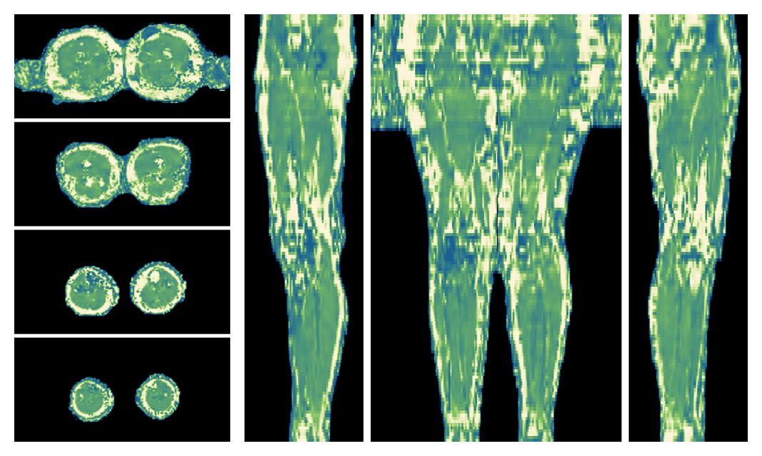 The water only T2 relaxation time of the lower extremity obtained from multi echo spin echo t2 mapping with EPG based reconstruction.