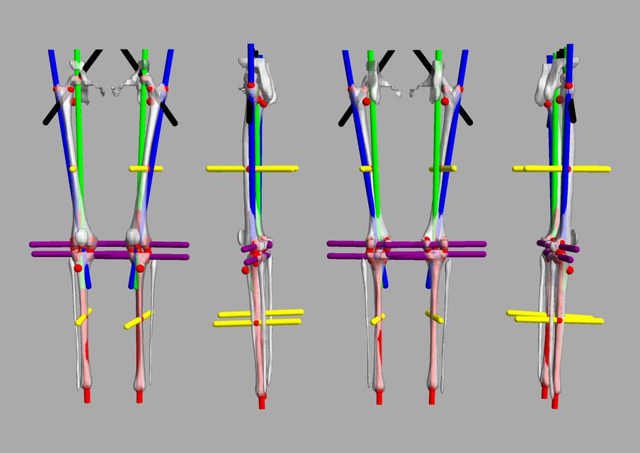 3D render of automated bone segmentation and force lines.