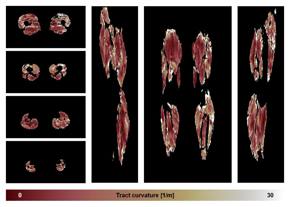 Muscle fiber tract curvature map based on whole leg DTI based fiber tractography.