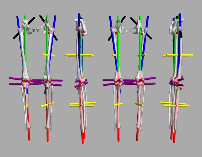 3D render of automated bone segmentation and force lines.