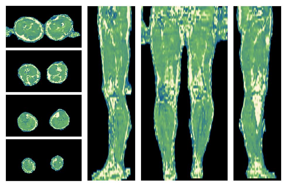 The water only T2 relaxation time of the lower extremity obtained from multi echo spin echo t2 mapping with EPG based reconstruction.