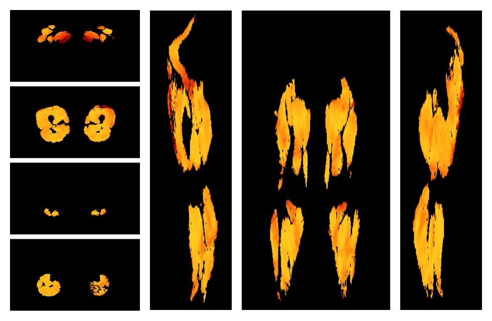 Muscle fiber tract angle map based on whole leg DTI based fiber tractography.